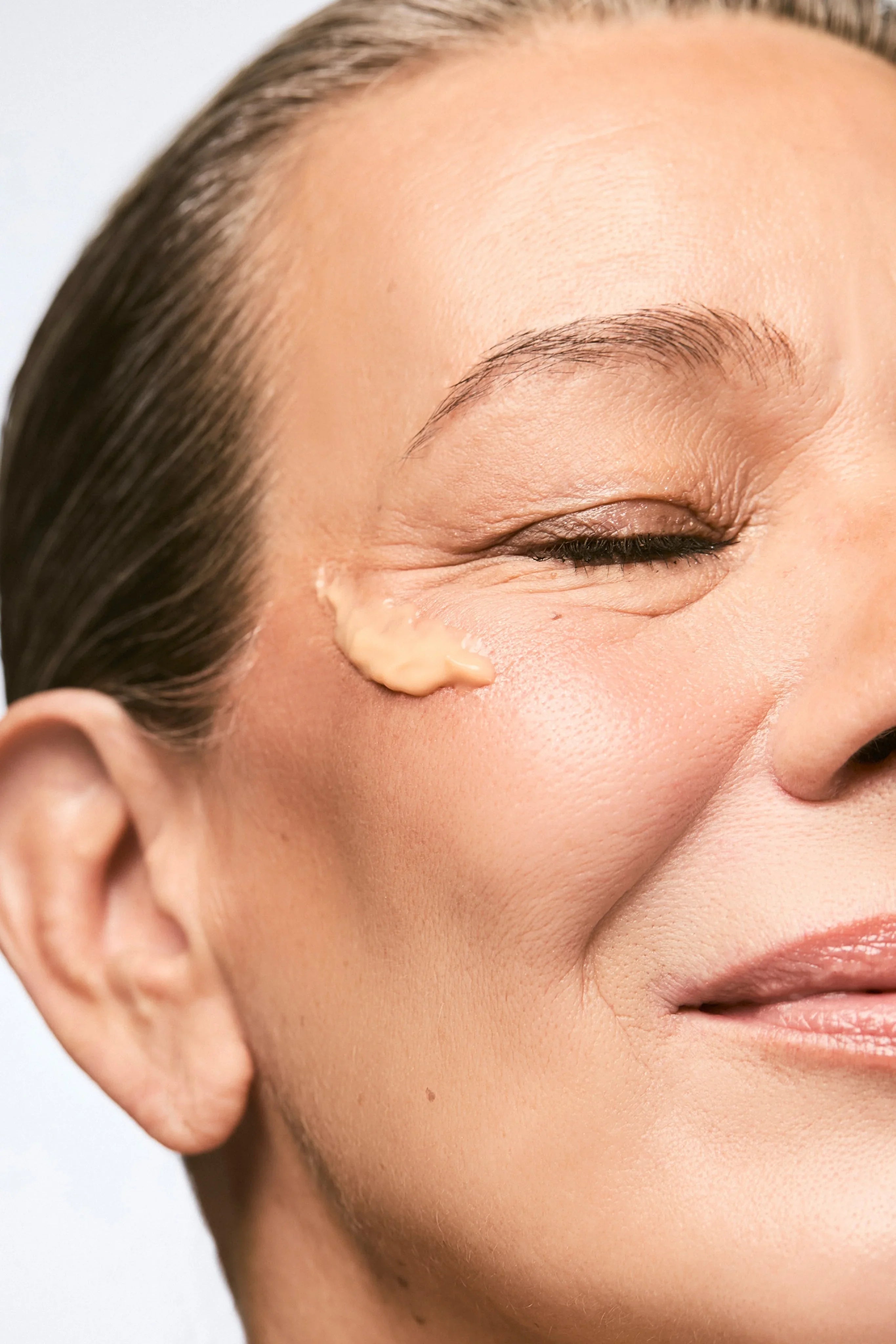 Pés de galinha: como prevenir e tratar linhas de expressão ao redor dos olhos