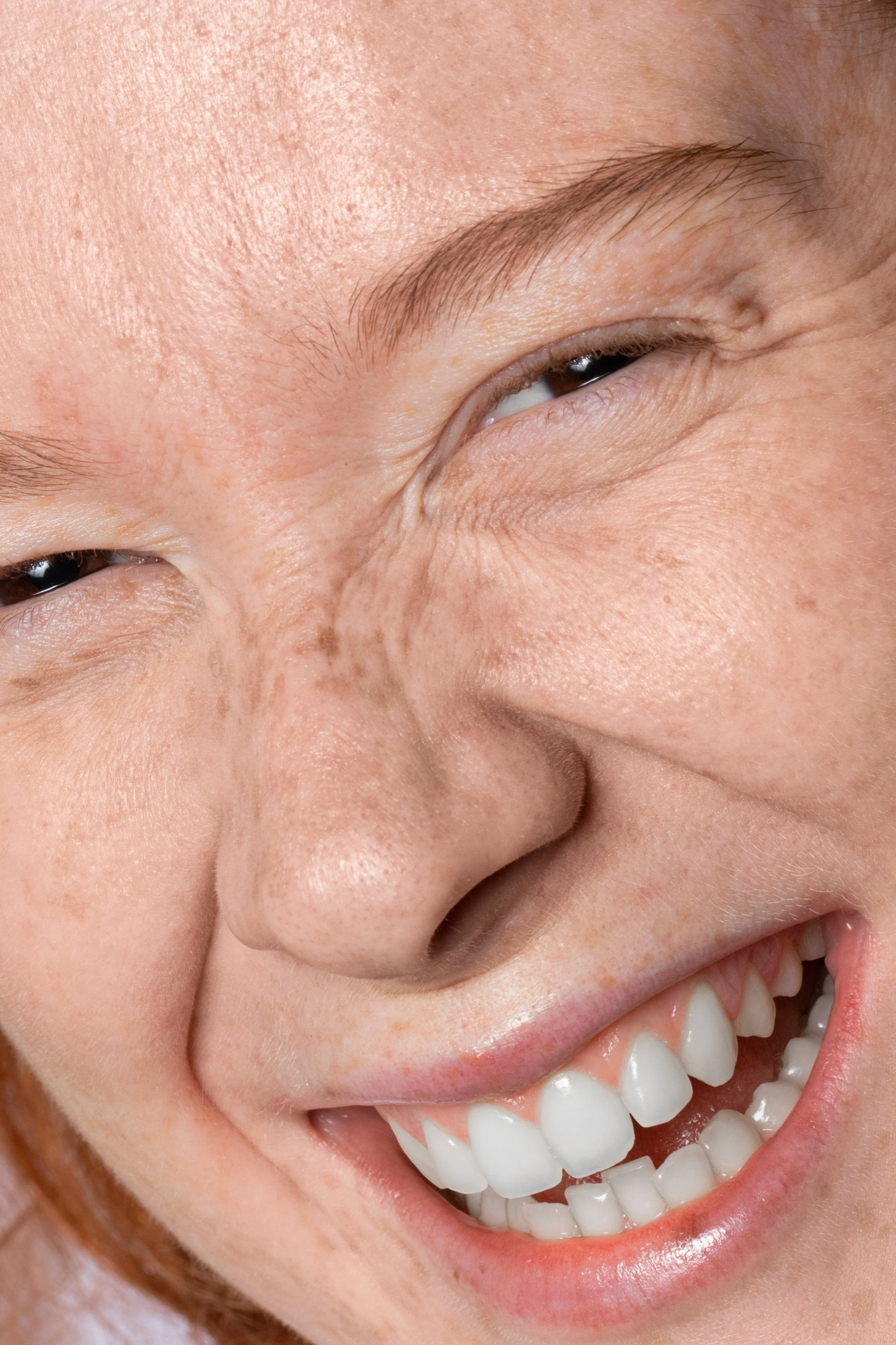 Linhas de expressão: o que funciona de verdade no skincare