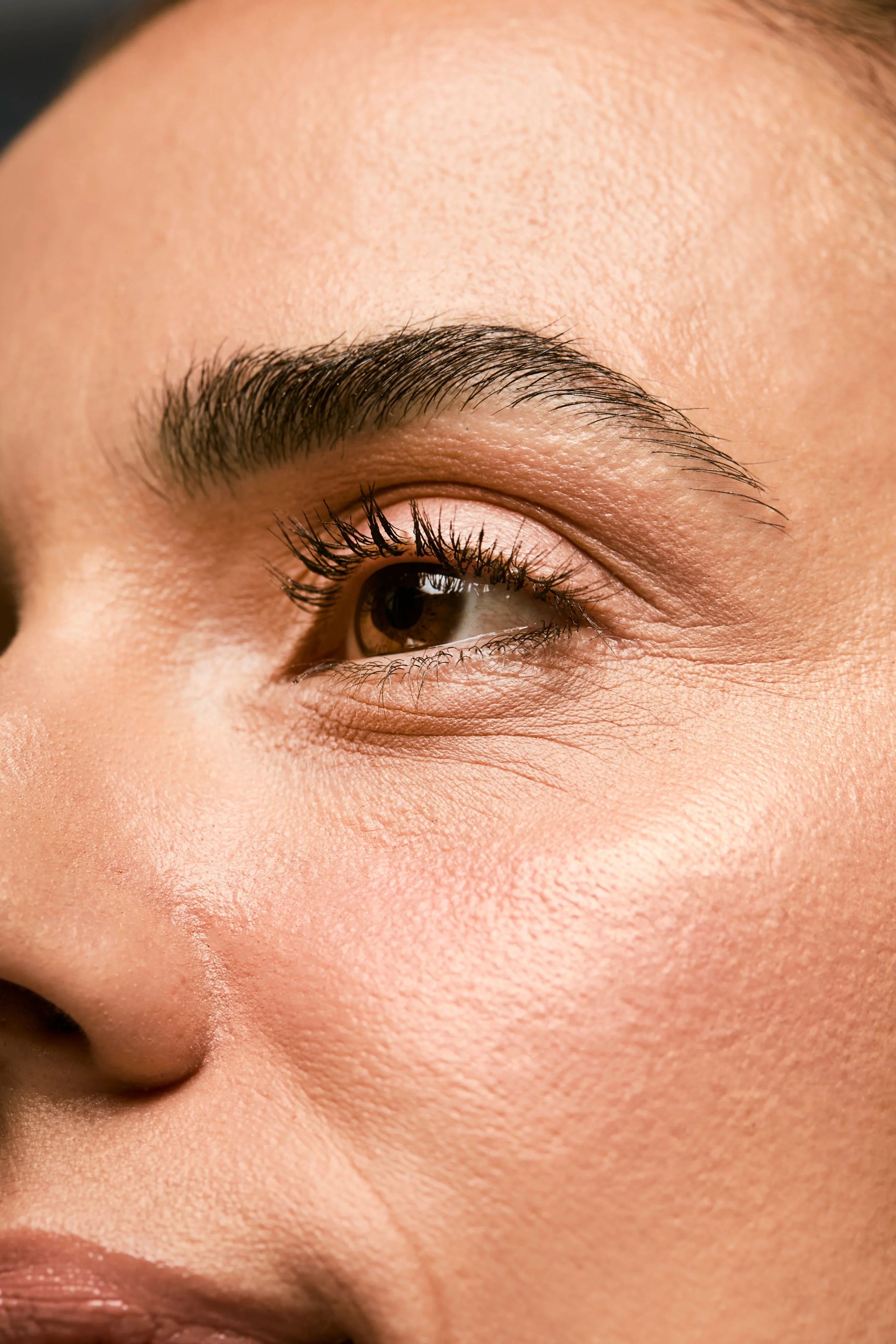 Olheiras: causas, tipos e tratamentos com produtos certos