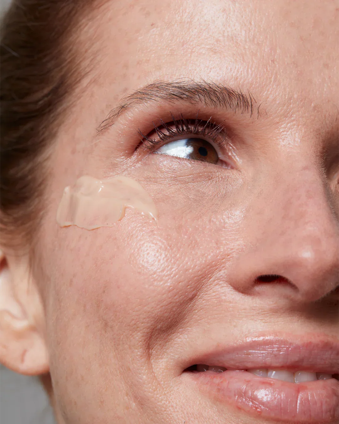 Como tratar olheiras de forma eficiente e segura