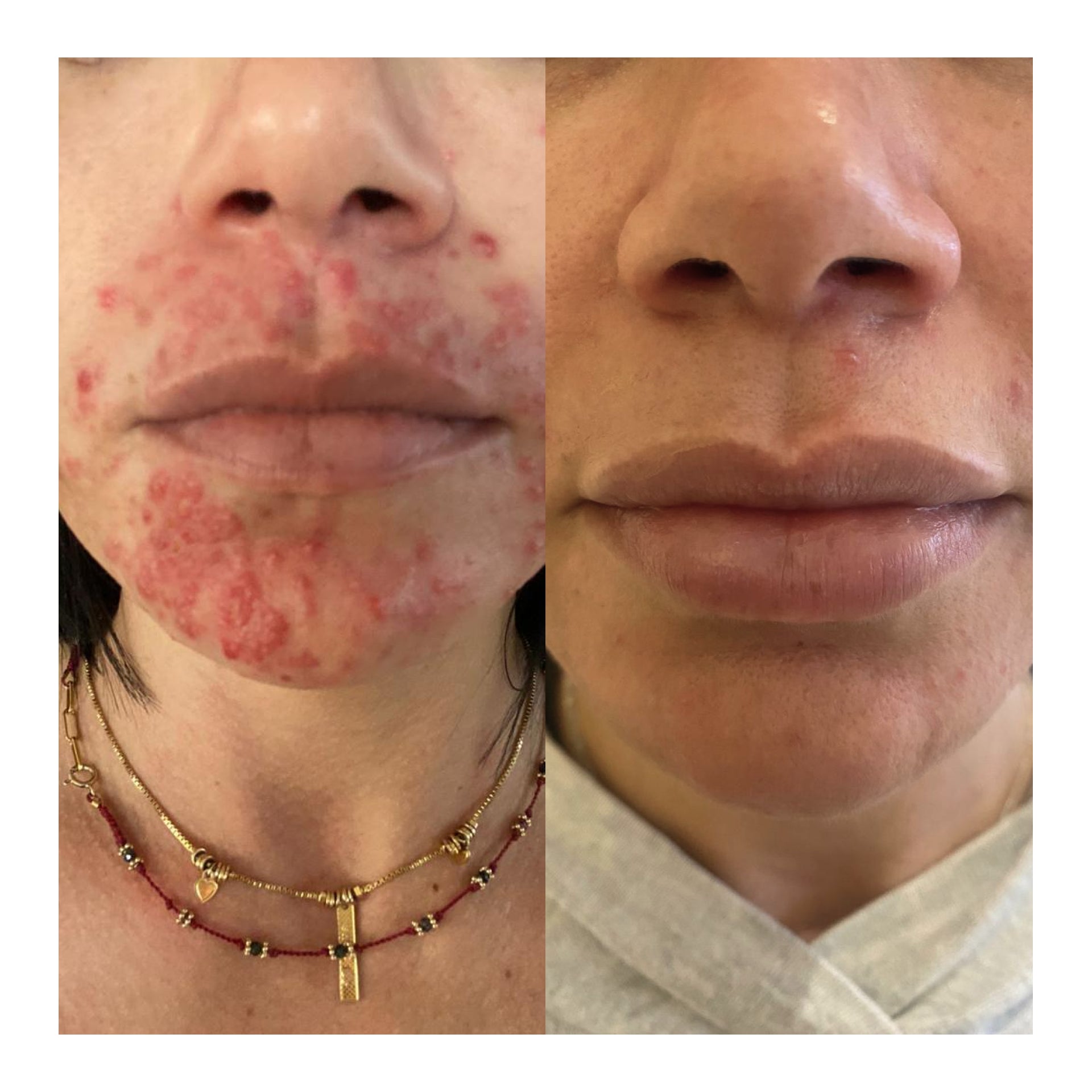 Dupla Molecular Serum